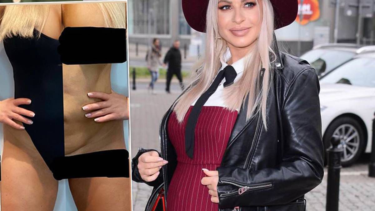 Polska gwiazda pokazała drastyczne zdjęcia swojego ciała po porodzie: "Nadal się go wstydzę"