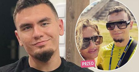 Conan Kaźmierski zachwycił metamorfozą. Jedno spojrzenie na twarz i widać, co zmienił. Dagmara nie kryje satysfakcji: "W końcu!"