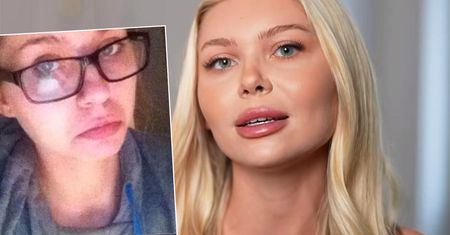 Martyna Kondratowicz pokazała stare zdjęcia. Pierwsze z wielu już widzicie. Przed operacjami to była inna osoba