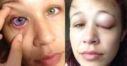 Zrobiła tatuaż w oku. Teraz ostrzega przed tym innych