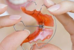 Duże zarobki fachowców. Ile zarabiają ortodonci?