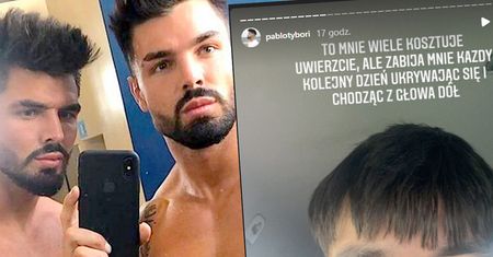 To straszne, jak Paweł z "Love Island" OSZPECIŁ się serią zabiegów. Przystojniak jest załamany: "Moja twarz już nie wróci do normalnego stanu"