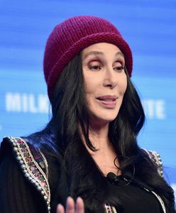 Cher poddała się eksperymentalnej terapii. Wszystko przez operacje plastyczne!