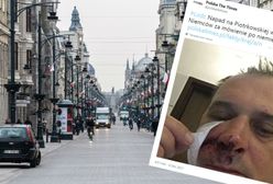 Pobili Niemców za mówienie po niemiecku. Ofiary napadu czekają na operacje