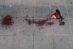 Tragiczna śmierć 19-latka. Chłopak umarł przez błędy szpitala i policji