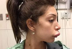 Farrah Abraham: amerykańska celebrytka ofiarą operacji plastycznej