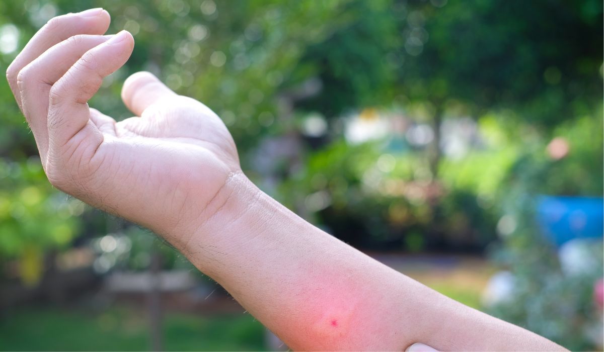 Chcąc uniknąć ukąszeń, warto jeść produkty, których zapachy odstraszają komary - Pyszności; Fot. Adobe Stock