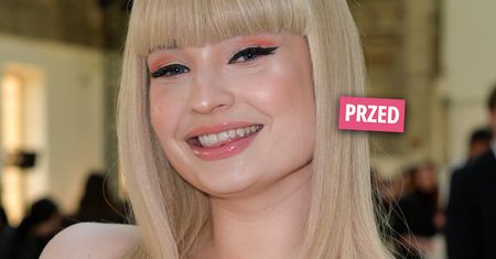 29-letnia Kim Petras oszpeciła się serią zabiegów upiększających. Zdjęcia twarzy piosenkarki przeraziły fanów