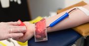 Naukowcy wiedzą jak sprawdzić poziom bólu