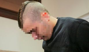 Łódź. Pobicie 4-miesięcznego dziecka. Ojciec usłyszał zarzut usiłowania zabójstwa córeczki