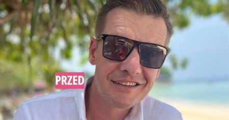 Rafał Mroczek przeszedł operację plastyczną. "Ale się w głowie przewraca" komentują fani