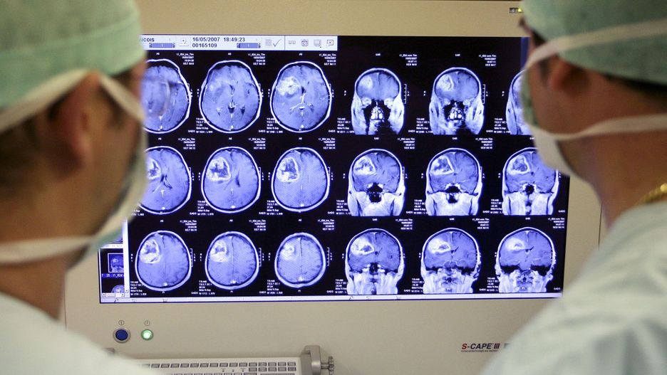 Człowiek może funkcjonować nawet z połową mózgu