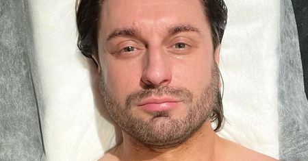 Rafał Grabias co do joty zrelacjonował, jak poprawia sobie twarz. Nas boli na sam widok! Wcześniej powiększył usta
