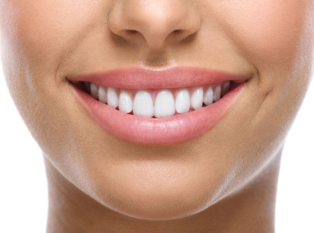 Różne rodzaje nakładek na zęby – właściwości i zastosowanie. Jakie wybrać?