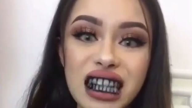 Na Instagramie znajdziemy efekty stosowania węglowej kuracji wybielającej.