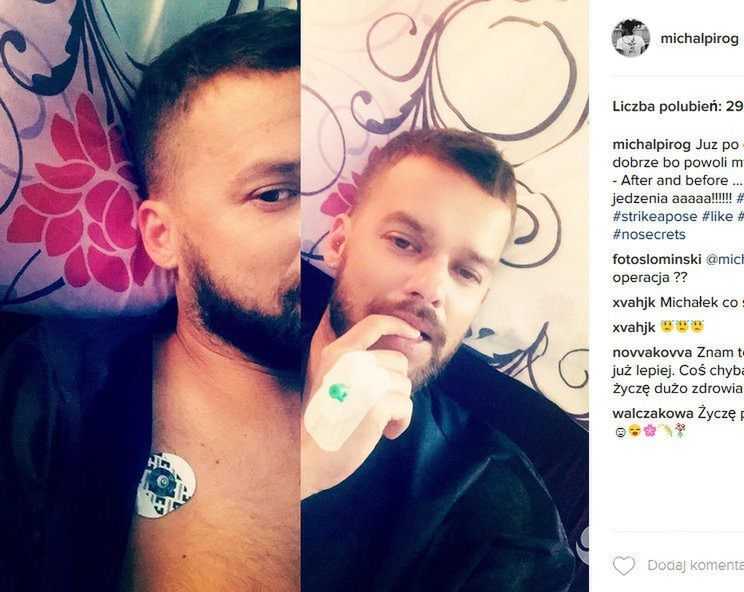 Michał Piróg przeszedł dzisiaj operację