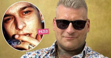Popek pociął sobie twarz, żeby się "upiększyć". Jak teraz wygląda? Zdjęcia po metamorfozie