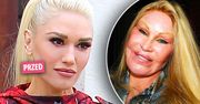 Co się stało z twarzą Gwen Stefani? "Wygląda jak kobieta kot". Aż ciężko uwierzyć, jak bardzo zmienili ją spece od medycyny estetycznej