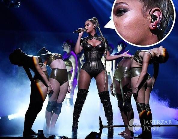 Beyonce zahaczyła o kolczyk na scenie