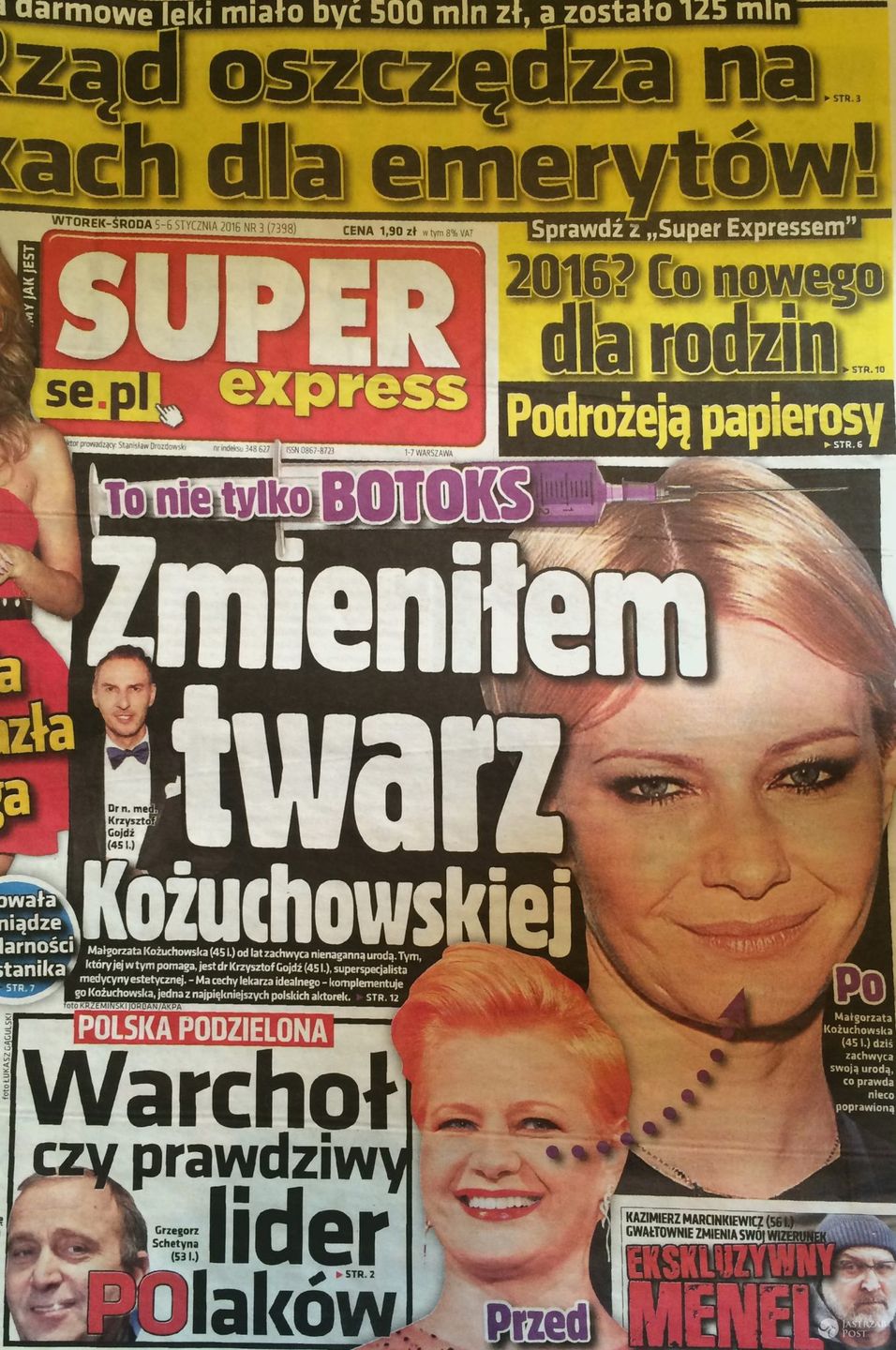 Co poprawiła sobie Małgorzata Kożuchowska? Krzysztof Gojdź ostro komentuje okładkę Super Expressu