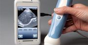 Mobilne badanie USG z telefonu