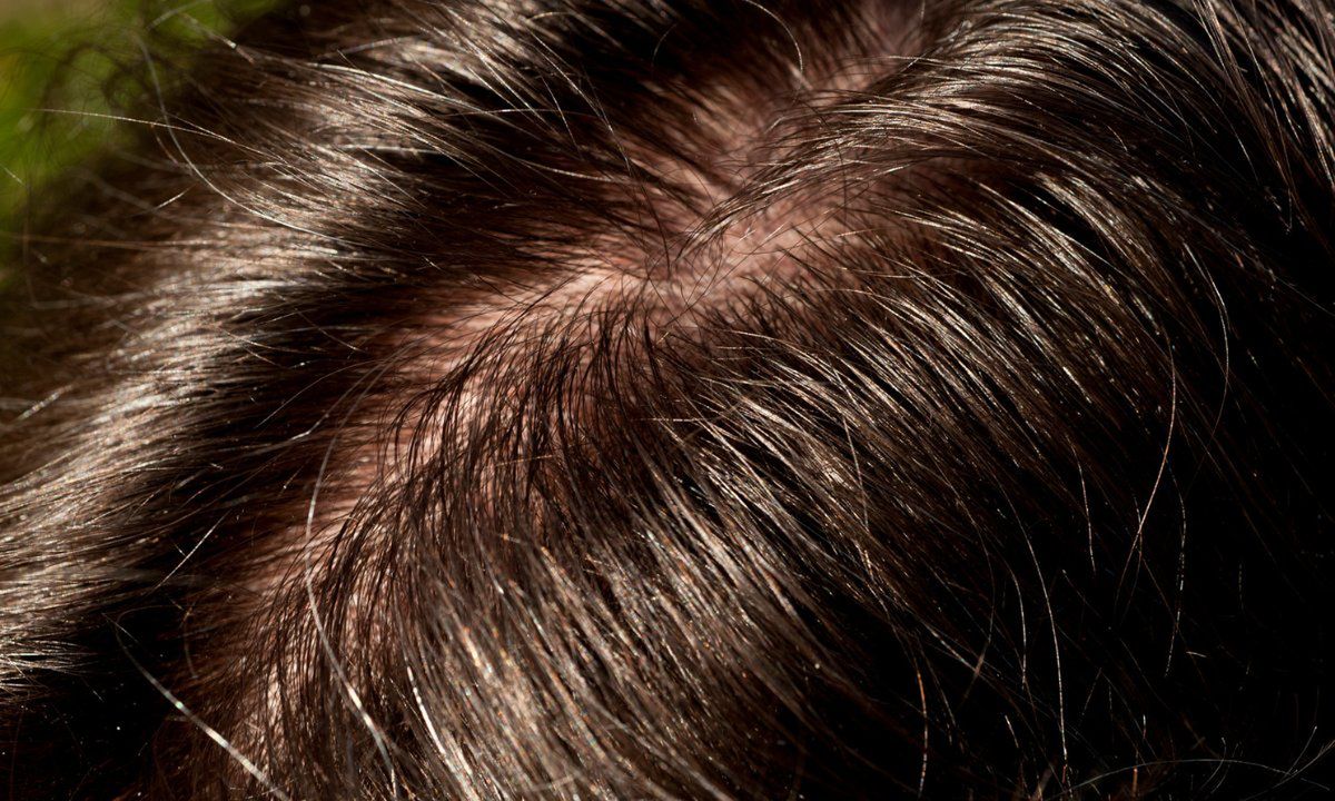 domowy sposób na tłuste włosy, fot. Getty Images