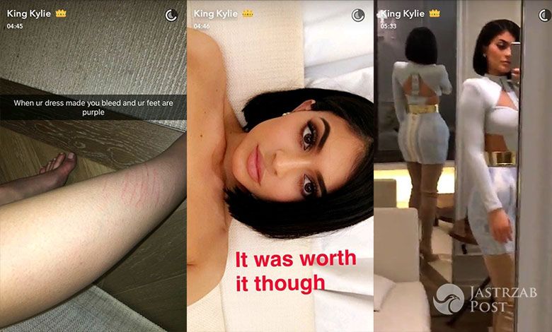 Kylie Jenner - MET Gala 2016