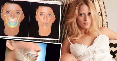 Jessica Mercedes ma dzisiaj bardzo poważną operację - lekarze połamią jej szczękę!
