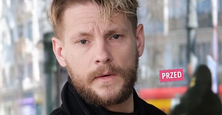 Sebastian Fabijański pokazał twarz po metamorfozie. Fani mocno podzieleni: "Stary Sebo wróć". Są też pochwały