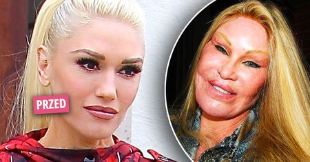 Co się stało z twarzą Gwen Stefani? "Wygląda jak kobieta kot". Aż ciężko uwierzyć, jak bardzo zmienili ją spece od medycyny estetycznej