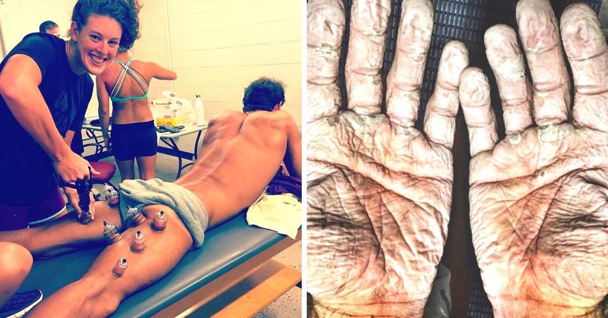 13 Photos that Show the Extraordinary Dedication of Athletes to Be the Best