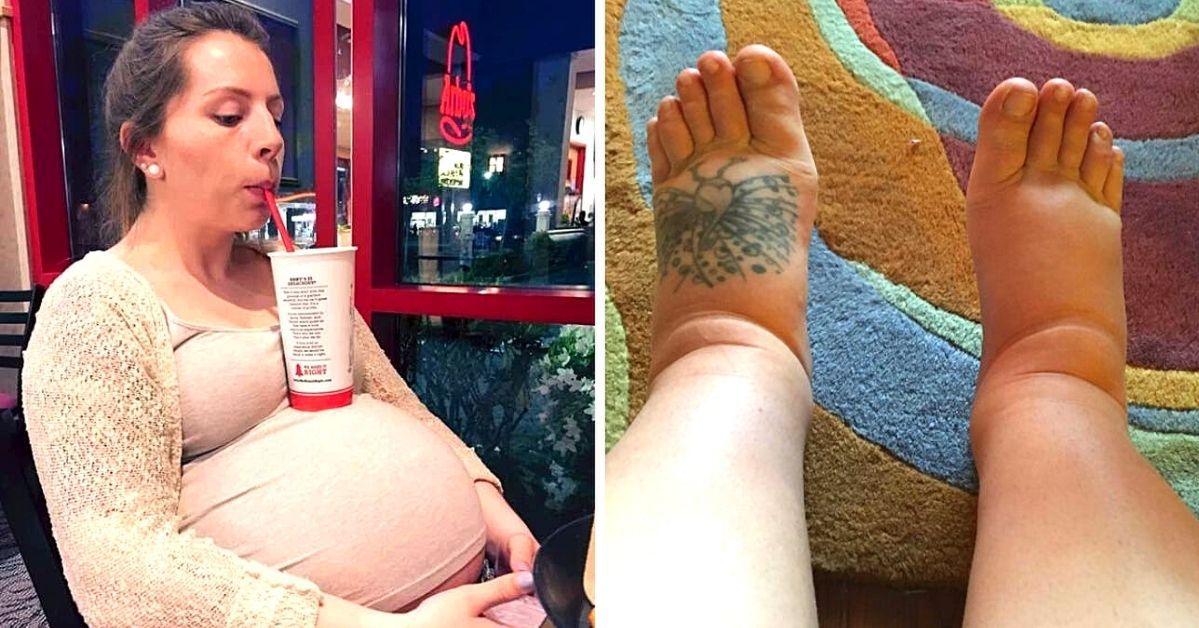 19 Unusual Things That Can Only Happen to Pregnant Women. Life With a Belly Isn't All Roses