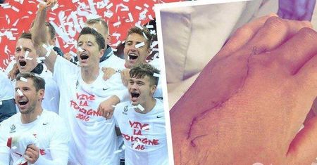 Groźny wypadek piłkarza reprezentacji Polski. Jest przerażające wideo i zdjęcia ze szpitala