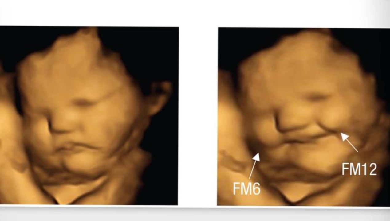 Co lubią nienarodzone dzieci? fot. Beyza Ustun/Durham University