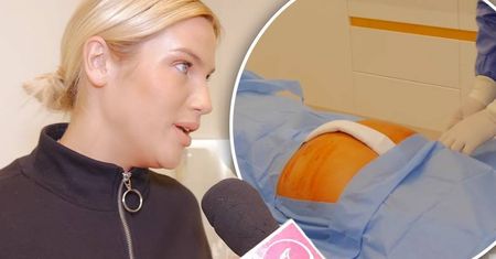Karolina Gilon i zabieg powiększenia pośladków w programie TTV! Mamy wideo z zabiegu! Wiemy ile to kosztuje! Tanio nie jest... [WIDEO]