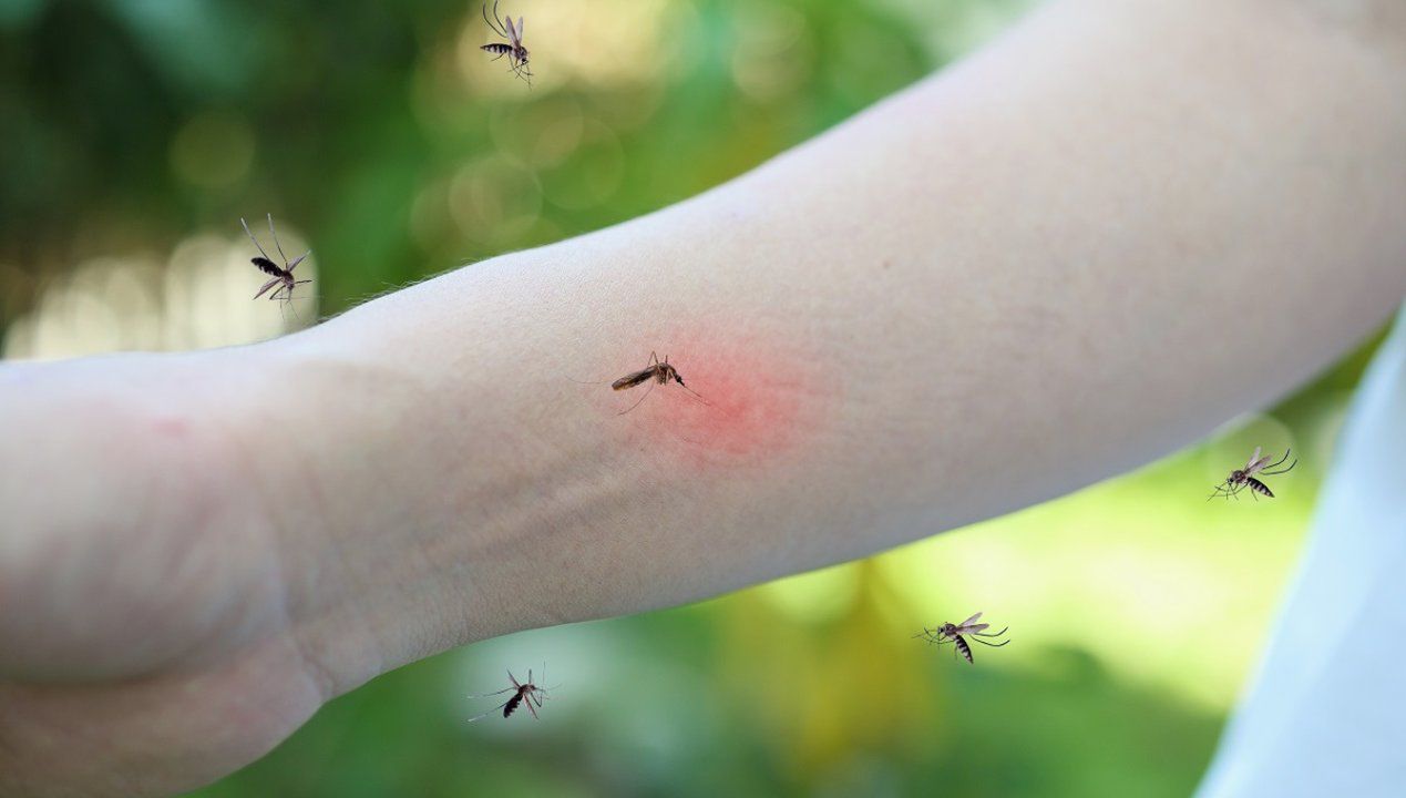 Oto 8 patentów-pewniaków na komary! Z nimi zapomnisz o swędzących ukąszeniach