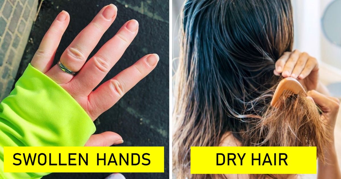 10 Symptoms the Weather Is Responsible for. And It’s Not Just the Pain in Your Joints!