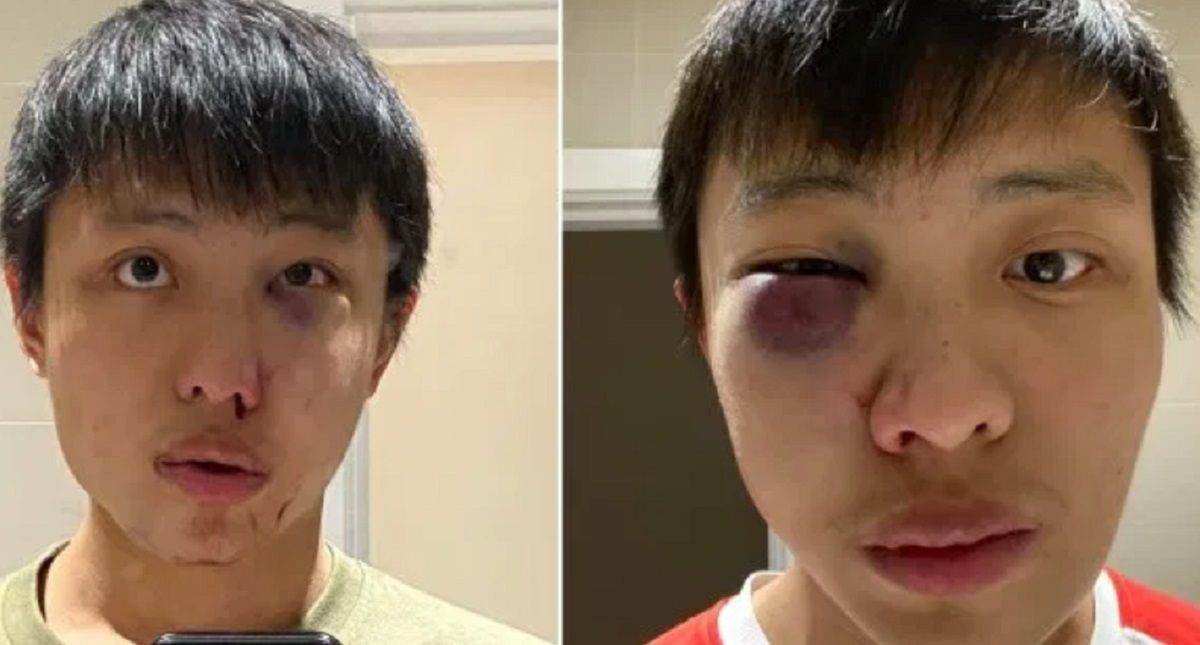 Rasistowski atak na studenta z Singapuru. Powodem koronawirus 