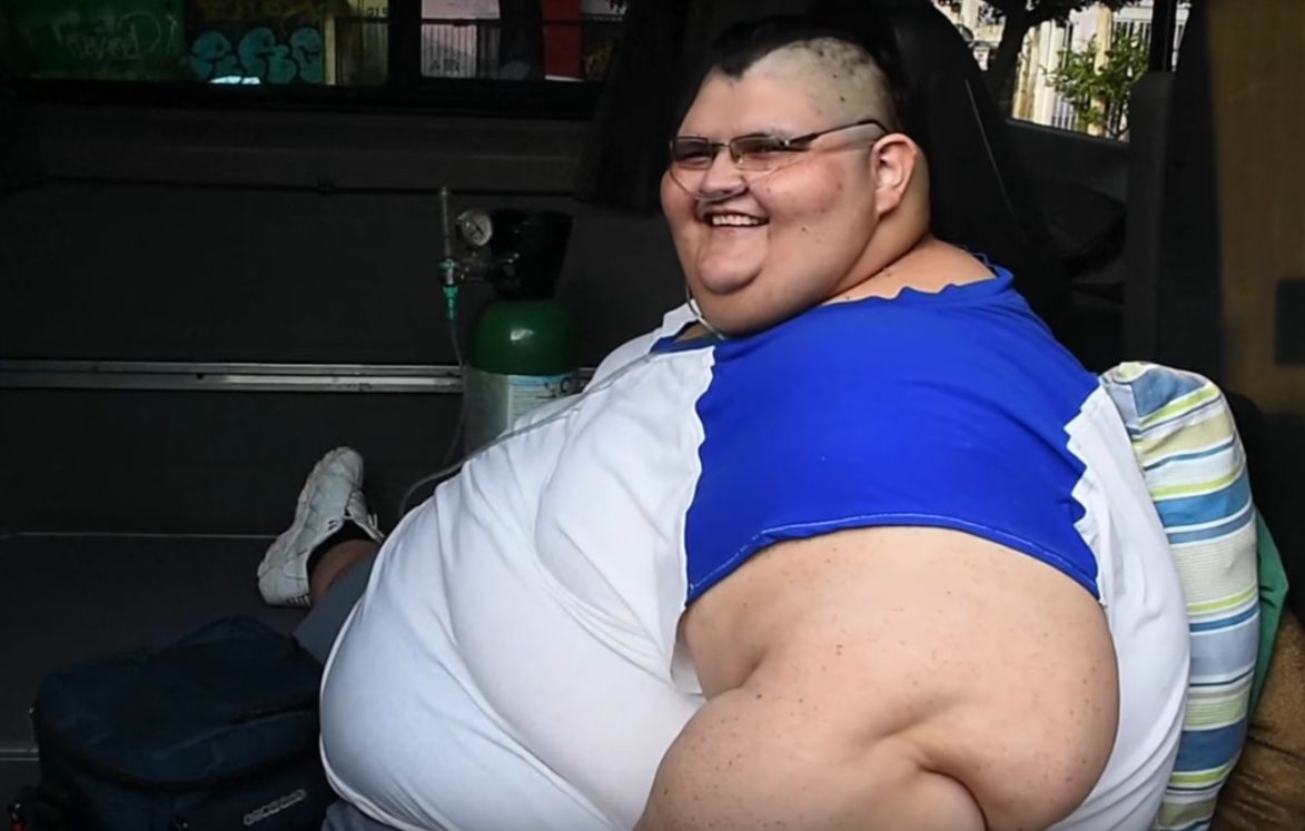 Najgrubszy człowiek świata schudł 175 kg! Teraz przygotowuje się do operacji