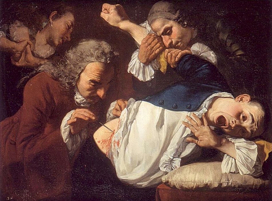 Operacje niczym tortury i trujące lub obrzydliwe lekarstwa – dawni lekarze nie przebierali w środkach, gdy przychodziło im testować swoje pomysły w praktyce 