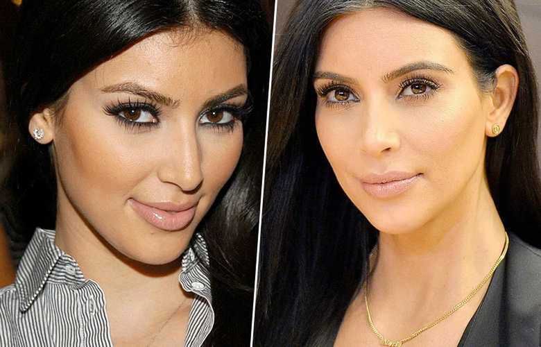 Kim Kardashian miała operację plastyczną nosa? Zdjęcia przed i po
