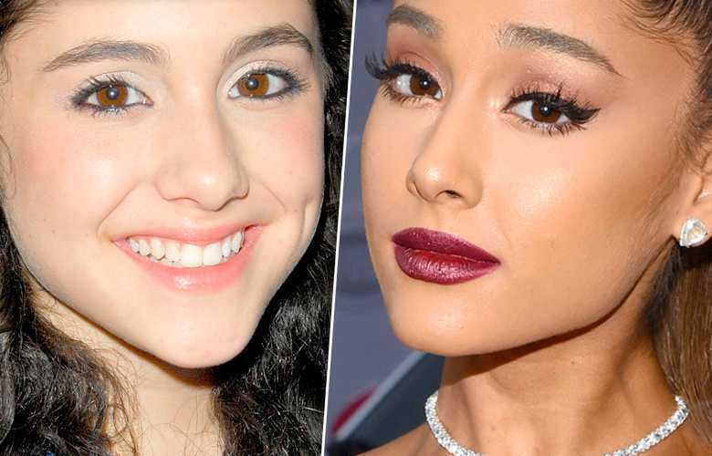 Ariana Grande miała operację plastyczną nosa? Zdjęcia przed i po