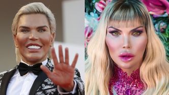 "Żywy Ken" Rodrigo Alves miał ponad 100 operacji, ale żałuje tylko jednej... Przyznał się do tego w nowym wywiadzie