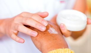 Atopowe zapalenie skóry – jaki krem będzie najlepszy dla skóry atopowej?