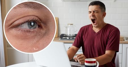 Dlaczego, gdy ziewam, lecą mi łzy? To problem większości osób