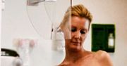 Sandra Lee nagrała swoją operację. "Ten film uratuje niejedno życie"