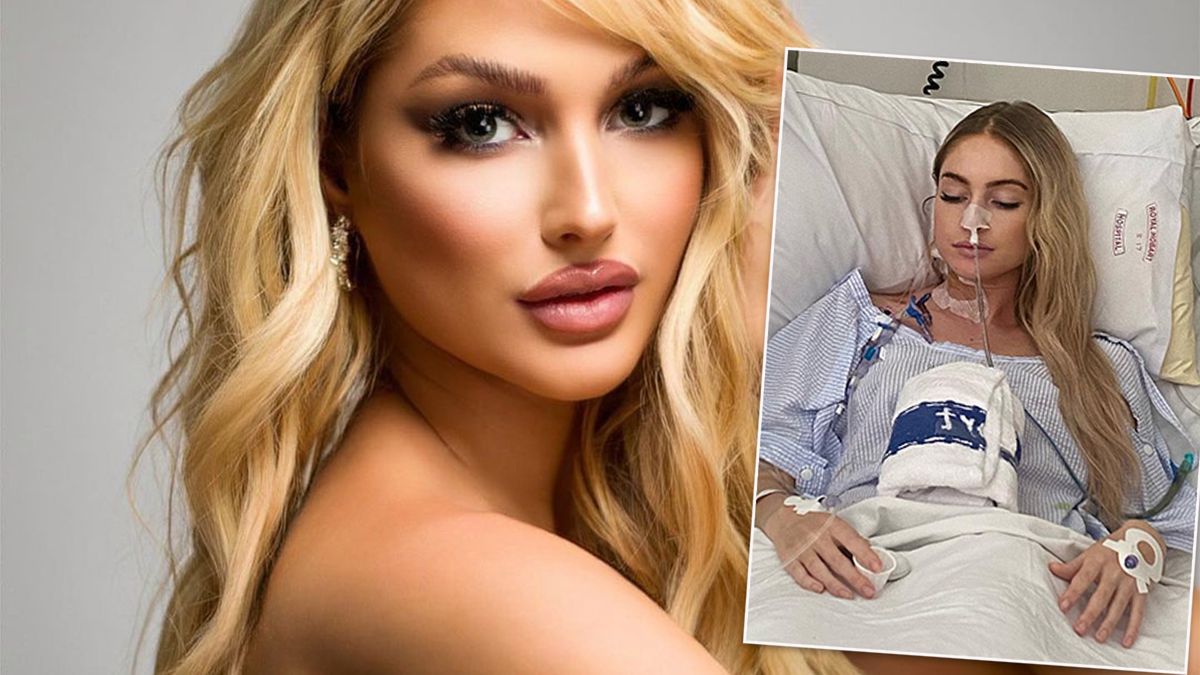 Modelka zachorowała na raka