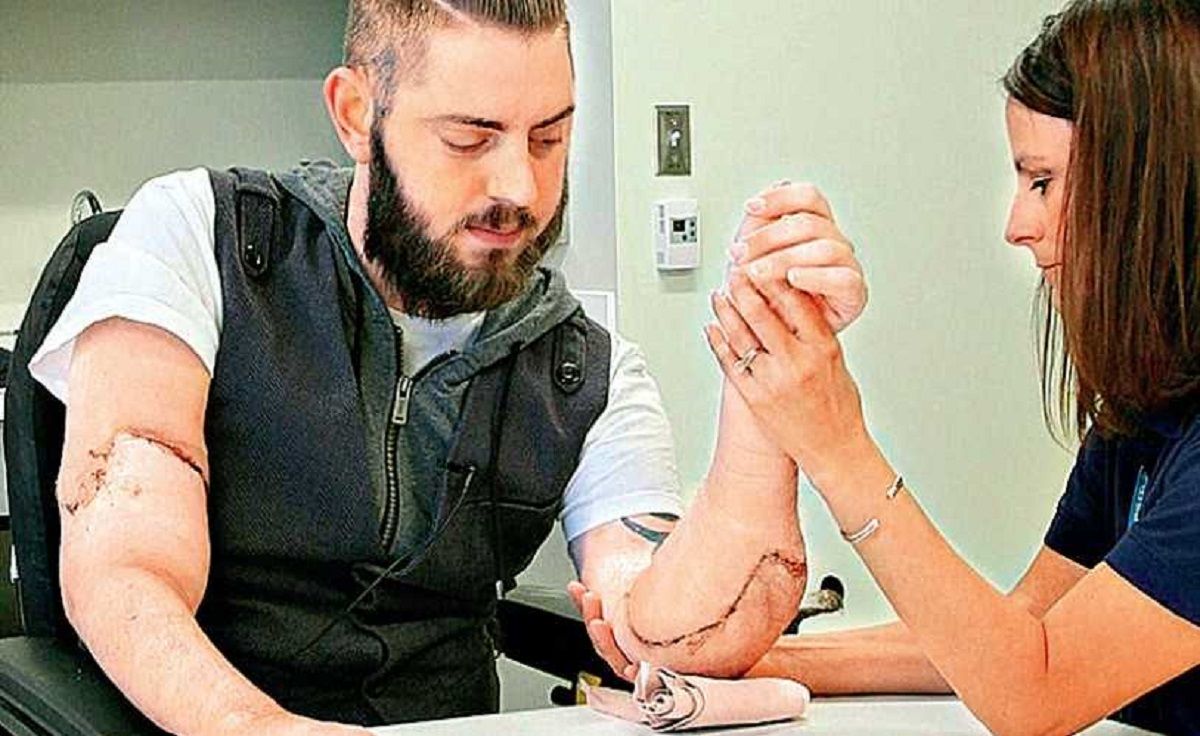 8 niezwykłych transplantacji