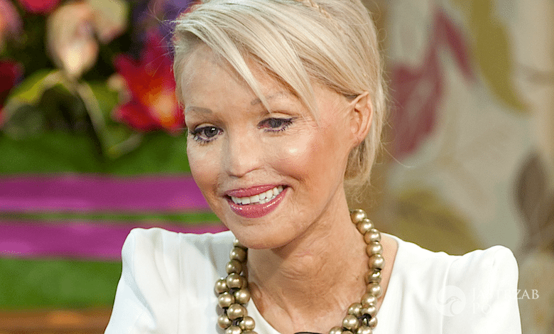 Katie Piper wzięła ślub