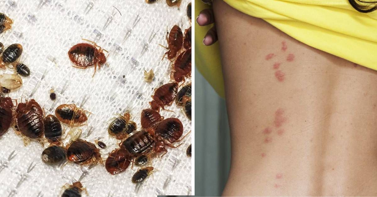 Jak pozbyć się pluskiew? Oto 10 naturalnych sposobów